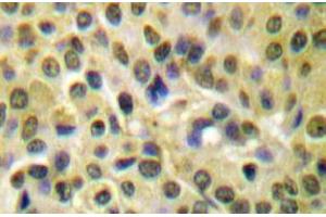 Image no. 1 for anti-V-Akt Murine Thymoma Viral Oncogene Homolog 1 (AKT1) (pSer473) antibody (ABIN317955) (AKT1 antibody  (pSer473))