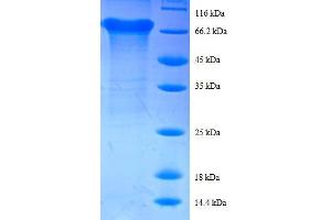 SDS-PAGE (SDS) image for Eukaryotic Translation Initiation Factor 4A2 (EIF4A2) (AA 1-407), (full length) protein (GST tag) (ABIN7479586)
