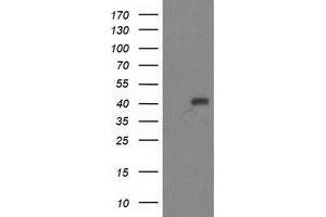 Western Blotting (WB) image for anti-Alcohol Dehydrogenase 1B (Class I), beta Polypeptide (ADH1B) antibody (ABIN1496478) (ADH1B antibody)