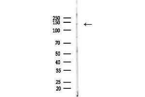 anti-Tyrosine Kinase 2 (TYK2) (C-Term) antibody