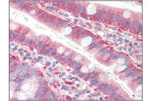 Immunohistochemistry (IHC) image for anti-Cofilin 1 (CFL1) (AA 1-166), (N-Term) antibody (ABIN336102) (Cofilin antibody  (N-Term))