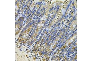 Immunohistochemistry of paraffin-embedded mouse intestine using NAA50 Antibody.