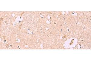 Immunohistochemistry of paraffin-embedded Human brain tissue using MKS1 Polyclonal Antibody at dilution of 1:50(x200)