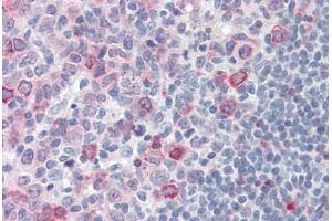 Anti-SUSD2 antibody  ABIN960826 IHC staining of human tonsil. (SUSD2 antibody  (Internal Region))