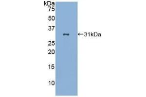 Detection of Recombinant LAB7-2, Human using Polyclonal Antibody to Cluster Of Differentiation 86 (CD86) (CD86 antibody  (AA 46-282))
