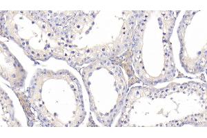 Detection of IGFBP1 in Bovine Testis Tissue using Polyclonal Antibody to Insulin Like Growth Factor Binding Protein 1 (IGFBP1) (IGFBPI antibody  (AA 112-263))
