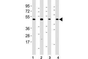 Western blot testing of Mlkl antibody at 1:2000 dilution and mouse samples: (1) lung, (2) NIH3T3, (3) liver, (4) testis lysate; Predicted size: 54 kDa. (MLKL antibody  (AA 444-472))