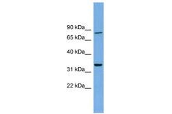 DDHD2 antibody  (AA 179-228)