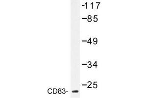 Image no. 1 for anti-CD83 (CD83) antibody (ABIN272283) (CD83 antibody)