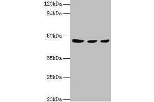 Western blot All lanes: ENTPD5 antibody at 4 μg/mL Lane 1: Mouse liver tissue Lane 2: Mouse kidney tissue Lane 3: Mouse gonad tissue Secondary Goat polyclonal to rabbit IgG at 1/10000 dilution Predicted band size: 48 kDa Observed band size: 48 kDa (ENTPD5 antibody  (AA 149-428))