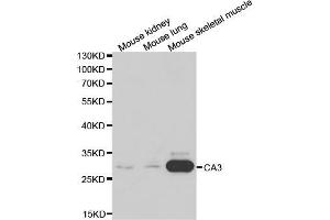 Western blot analysis of extracts of various cell lines, using CA3 antibody (ABIN5970554) at 1/1000 dilution.