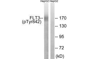 Western blot analysis of extracts from HepG2 cells, treated with EGF (200ng/ml, 30mins), using FLT3 (Phospho-Tyr842)) antibody. (FLT3 antibody  (pTyr842))