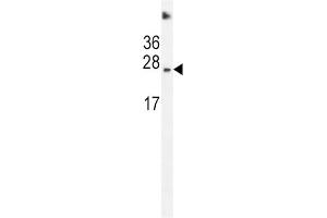 Western Blotting (WB) image for anti-Succinate Dehydrogenase Complex, Subunit D, Integral Membrane Protein (SDHD) antibody (ABIN2996554) (SDHD antibody)