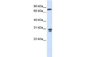 WB Suggested Anti-NIT2 Antibody Titration:  0. (NIT2 antibody  (Middle Region))