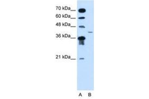 Image no. 1 for anti-Microfibrillar-Associated Protein 3-Like (MFAP3L) (AA 104-153) antibody (ABIN205052) (MFAP3L antibody  (AA 104-153))