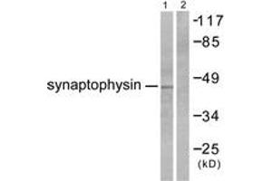 Western blot analysis of extracts from LOVO cells, using Synaptophysin Antibody. (Synaptophysin antibody  (AA 101-150))