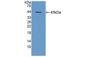 Figure. (TPP1 antibody  (AA 198-562))