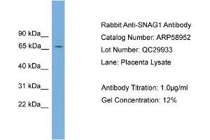 WB Suggested Anti-SNAG1  Antibody Titration: 0. (SNX18 antibody  (C-Term))