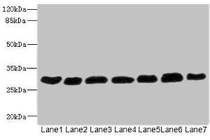 Western blot All lanes: PGAM2 antibody at 7. (PGAM2 antibody  (AA 1-253))