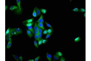 Immunofluorescence staining of Hela cells with ABIN7156446 at 1:200, counter-stained with DAPI. (ITGA6 antibody  (AA 625-866))