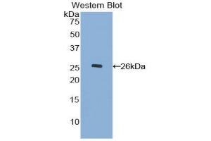 Western Blotting (WB) image for anti-Mucin 17, Cell Surface Associated (MUC17) (AA 3773-3998) antibody (ABIN1078335) (MUC17 antibody  (AA 3773-3998))