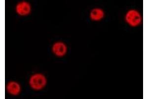 ABIN6277189 staining HepG2 by IF/ICC. (UHRF2 antibody  (Internal Region))