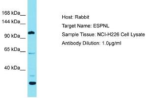 Host: Rabbit Target Name: ESPNL Sample Tissue: Human NCI-H226 Whole Cell Antibody Dilution: 1ug/ml (ESPNL antibody  (C-Term))