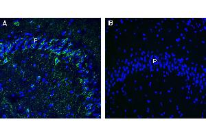 Expression of Leptin Receptor in mouse hippocampus. (Leptin Receptor antibody  (Extracellular))