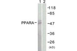 Western blot analysis of extracts from NIH-3T3 cells, using PPAR-alpha (Ab-21) Antibody. (PPARA antibody  (AA 6-55))