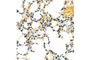 Immunohistochemistry (Paraffin-embedded Sections) (IHC (p)) image for anti-HLA-DR-gamma (CD74) antibody (ABIN7074245)