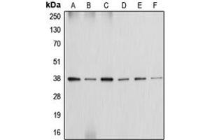 Western blot analysis of Annexin A2 expression in HeLa (A), MCF7 (B), Raw264. (Annexin A2 antibody  (Center))