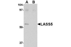Western blot analysis of LASS5 in SK-N-SH lysate with LASS5 antibody at 1 µg/ml in the (A) absence and (B) presence of blocking peptide. (LASS5 antibody  (C-Term))