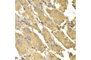 Immunohistochemistry of paraffin-embedded human stomach using PPP2CA antibody. (PPP2CA antibody  (AA 1-309))