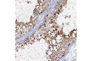 Immunohistochemical staining of human testis with ACRBP polyclonal antibody  shows strong cytoplasmic(acrosomal) positivity in cells of seminiferous ducts. (ACRBP antibody)