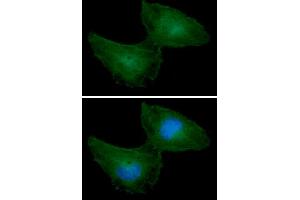 ICC/IF analysis of PRPS1 in HeLa cells line, stained with DAPI (Blue) for nucleus staining and monoclonal anti-human PRPS1 antibody (1:100) with goat anti-mouse IgG-Alexa fluor 488 conjugate (Green). (PRPS1 antibody)