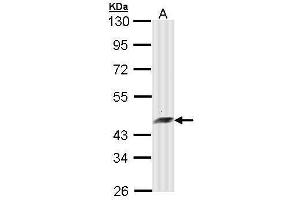 WB Image Sample (30 ug of whole cell lysate) A: Molt-4 , 10% SDS PAGE antibody diluted at 1:10000 (ARFIP2 antibody)