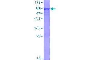 Adenylosuccinate Lyase Protein (ADSL) (AA 1-484) (GST tag)