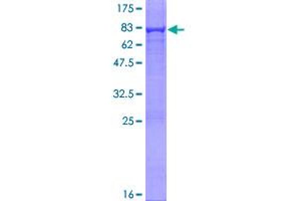 Adenylosuccinate Lyase Protein (ADSL) (AA 1-484) (GST tag)