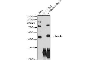 Immunoprecipitation analysis of 300 μg extracts of HeLa cells using 3 μg γ-Tubulin antibody (ABIN7271051). (TUBG1 antibody)