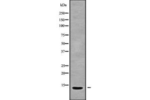 Western blot analysis IGFL2 using 293 whole cell lysates (IGFL2 antibody)