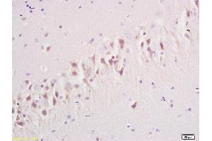 Formalin-fixed and paraffin embedded rat brain tissue labeled with Anti GRM1 Polyclonal Antibody,Unconjugated (ABIN734663) at 1:200 followed by conjugation to the secondary antibody and DAB staining. (mGluR1 + mGluR5 antibody  (AA 651-750))