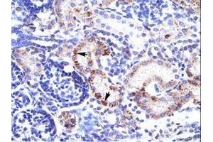 Image no. 1 for anti-Regulating Synaptic Membrane Exocytosis 3 (RIMS3) (C-Term) antibody (ABIN202211) (RIMS3 antibody  (C-Term))