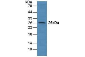 Detection of GSTA4 in Human Lung Tissue using Polyclonal Antibody to Glutathione S Transferase A4 (GSTA4) (GSTA4 antibody  (AA 3-222))
