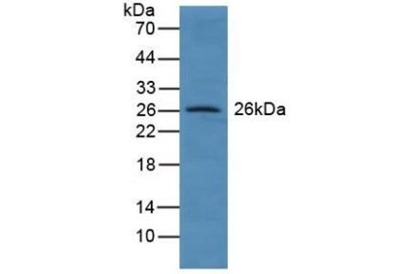GSTA4 Antikörper  (AA 3-222)