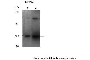 Sample Type: 1. (EIF4G2 antibody  (C-Term))
