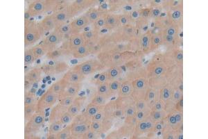 Used in DAB staining on fromalin fixed paraffin- embedded Kidney tissue (UBAP1 antibody  (AA 1-295))