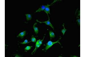 Immunofluorescent analysis of U251 cells using ABIN7149396 at dilution of 1:100 and Alexa Fluor 488-congugated AffiniPure Goat Anti-Rabbit IgG(H+L) (CIAO3 (AA 2-265) antibody)