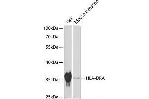 Western blot analysis of extracts of various cell lines using HLA-DRA Polyclonal Antibody at dilution of 1:1000. (HLA-DRA antibody)