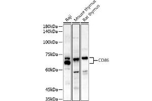 Western blot analysis of extracts of various cell lines, using CD86 antibody (ABIN7266226) at 1:500 dilution. (CD86 antibody)