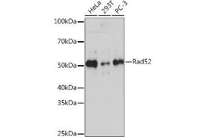 Western blot analysis of extracts of various cell lines, using Rad52 Rabbit mAb (ABIN7269828) at 1:1000 dilution. (RAD52 antibody)